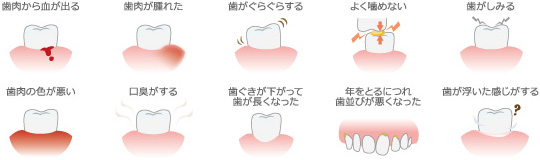歯周病の主な症状
